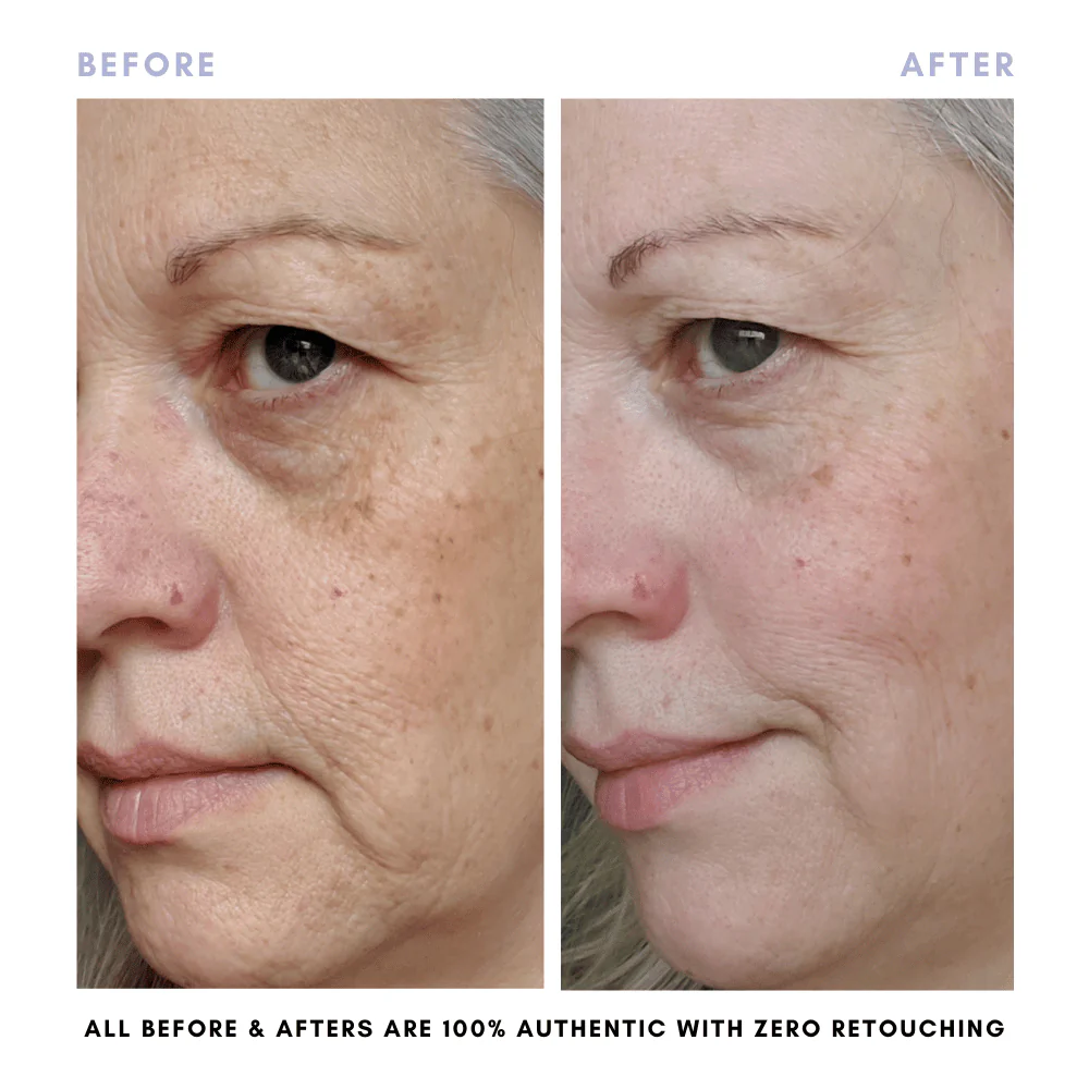 BUNDLE & SAVE! The Balancing Treatment Duo - Image 6