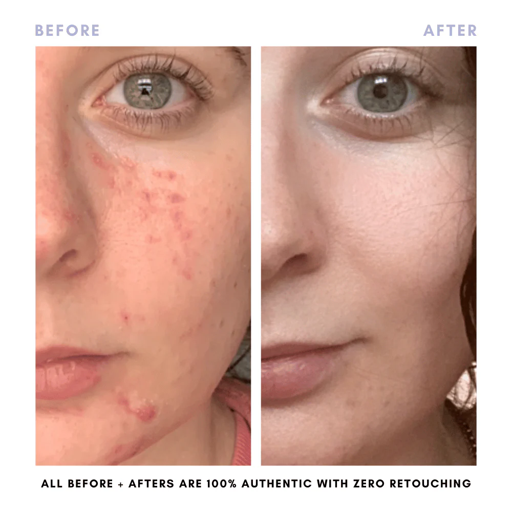 BUNDLE & SAVE! The Double Cleansing Duo - Image 6
