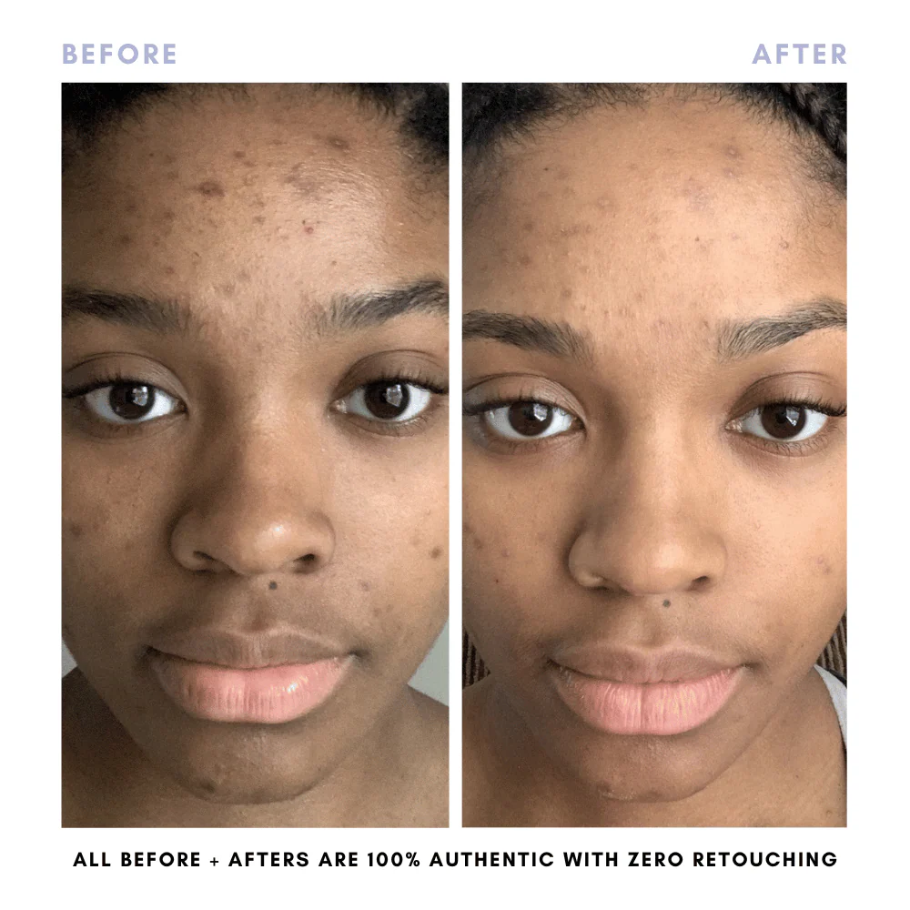 BUNDLE & SAVE! The Skin Reset Starter Kit - Image 8