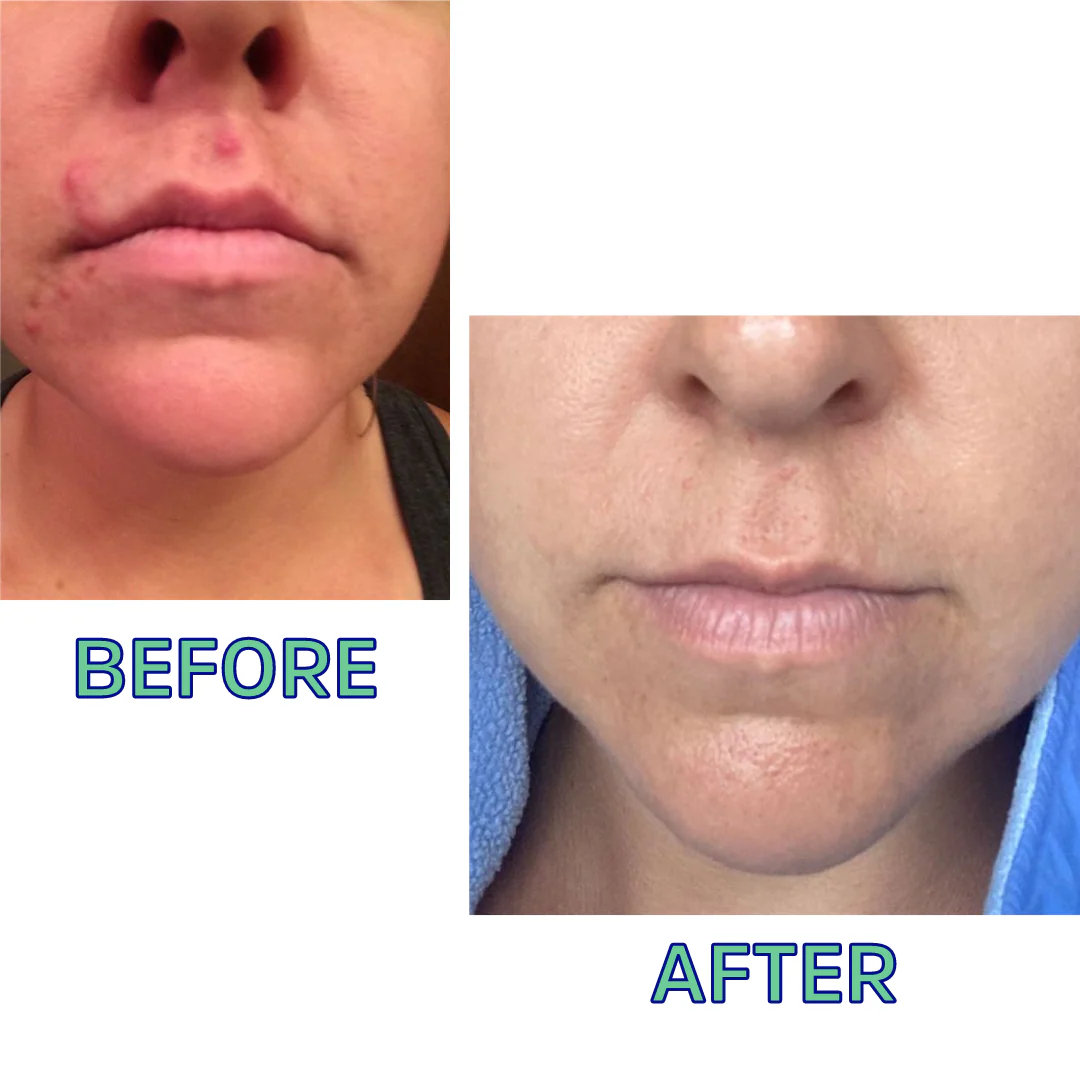 Cleansing Oil For Normal/Combo Skin 4 Oz by FATCO Skincare Products - Image 3