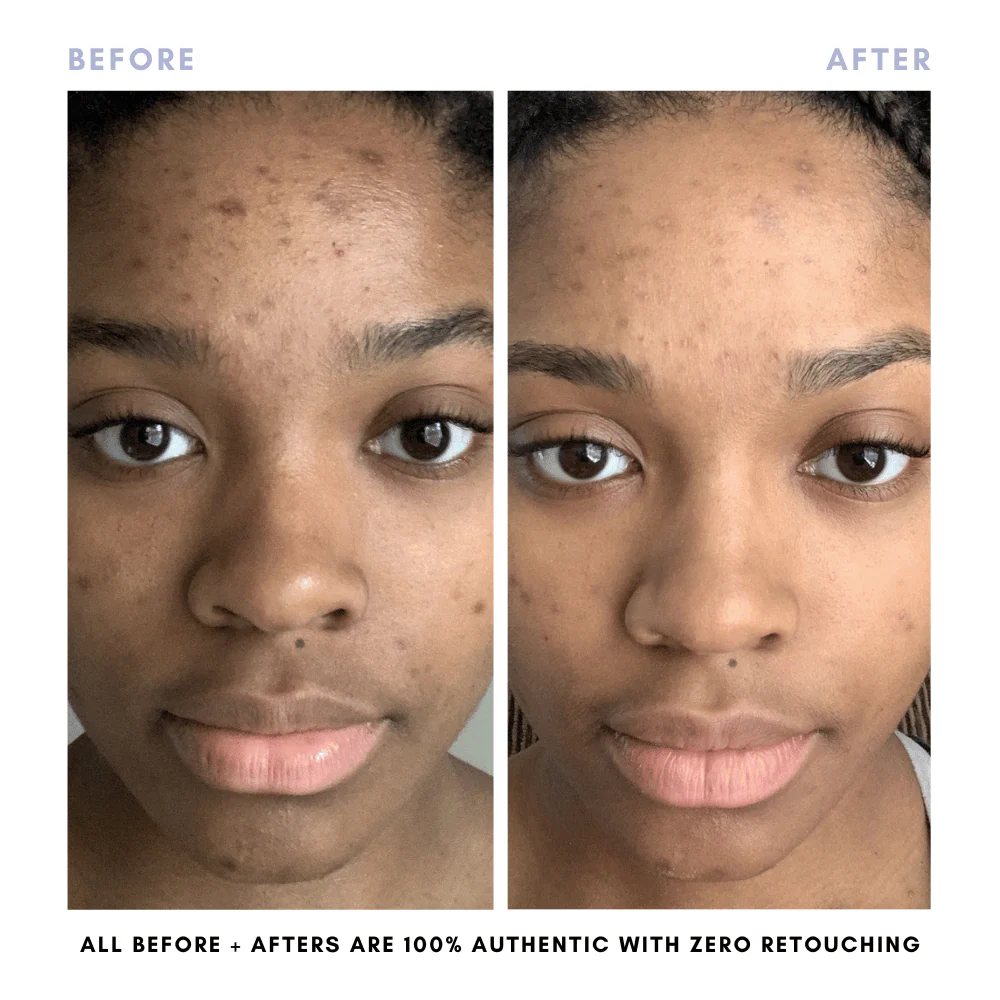 The Complete Skincare Collection - Image 12