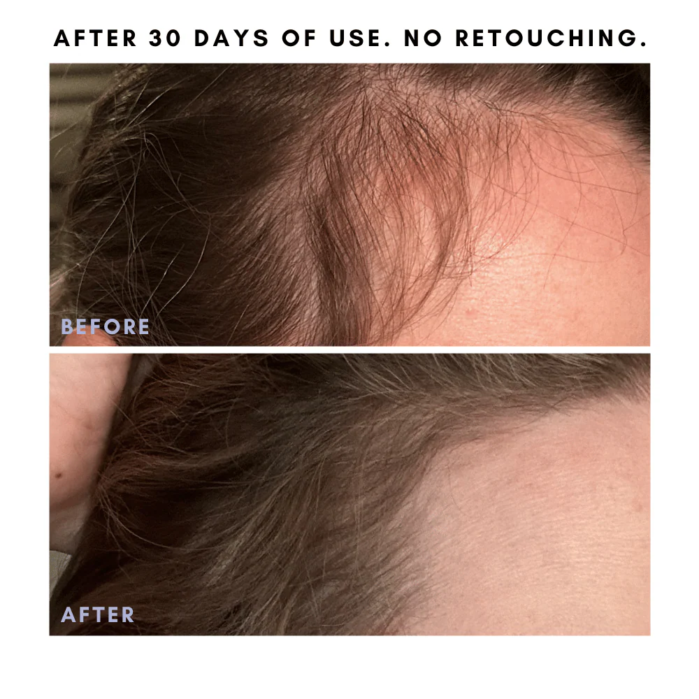 The Hair + Skin Boosting Bundle - Image 4